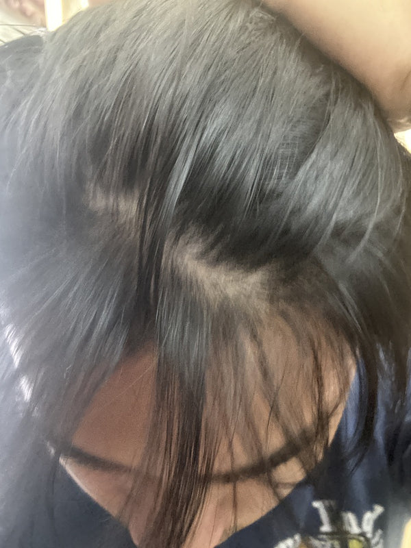My dandruff is all gone!